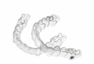 Invisalign aligners